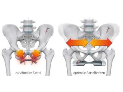 zu schmaler bzw. optimaler Sattel